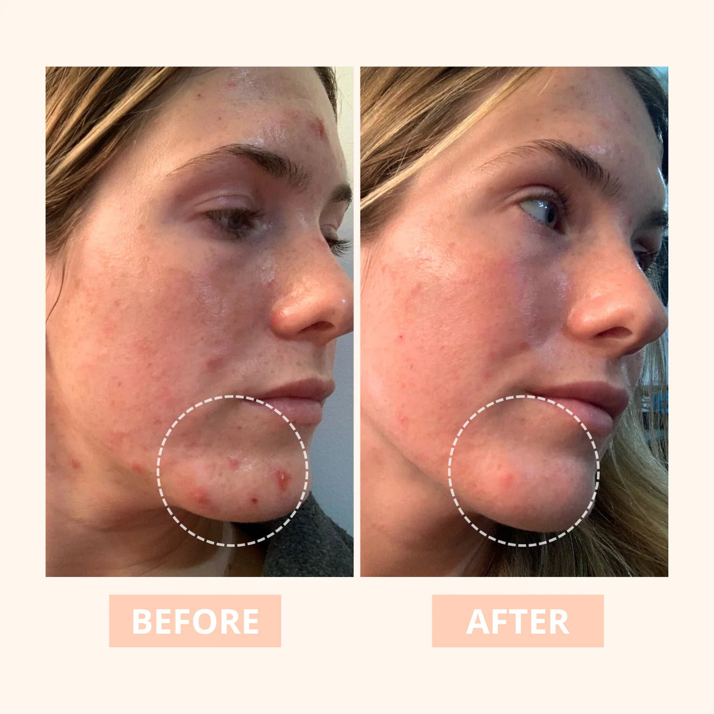 Truly - Cleansing Facial Cleanser