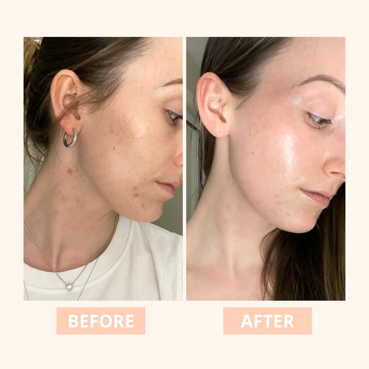 Truly - Clear Spot Treatment