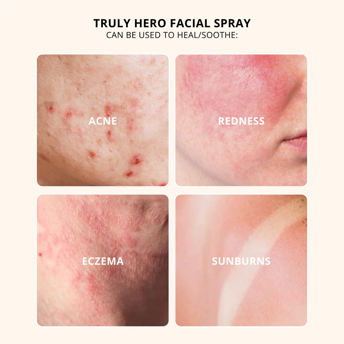 Truly - Hero Facial Spray