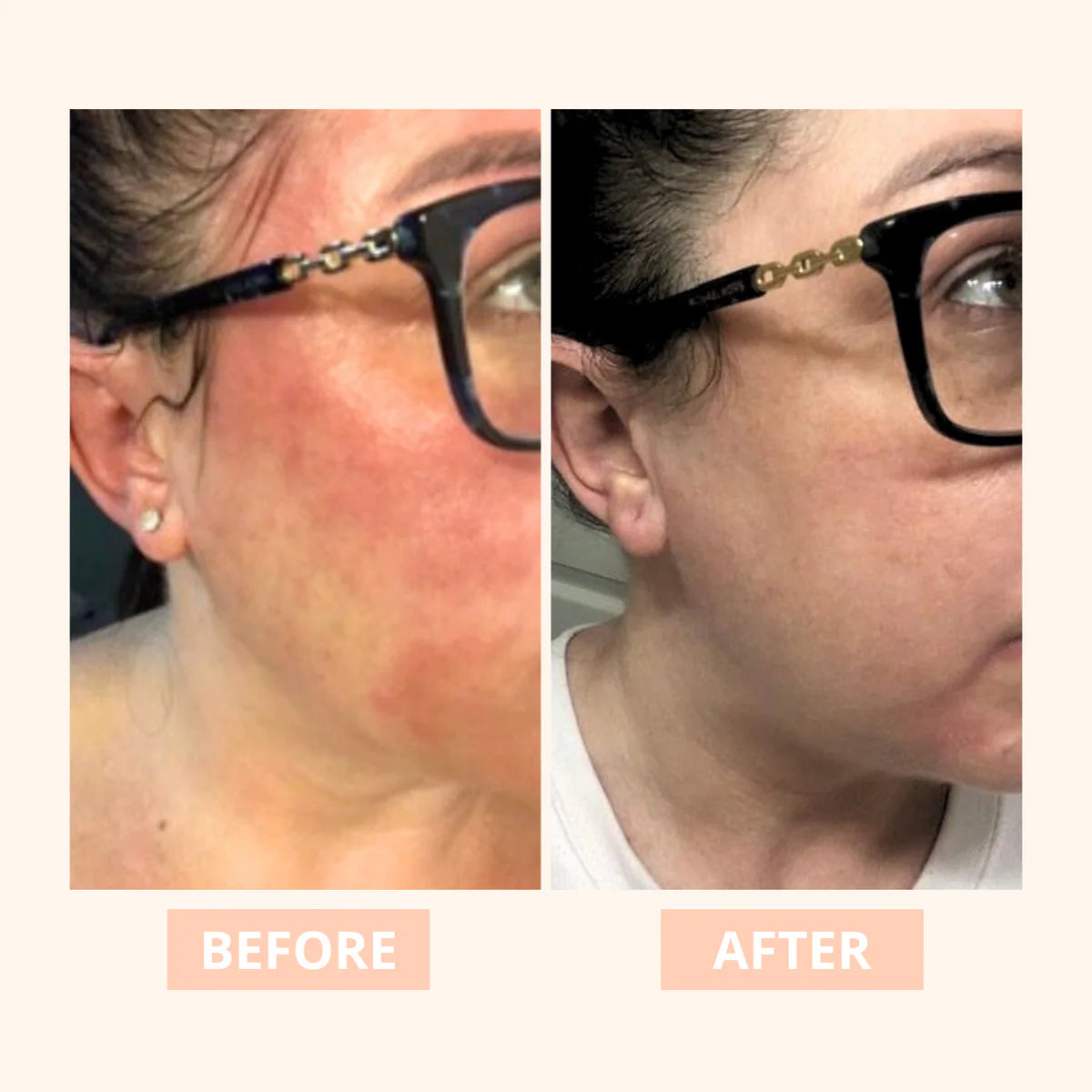 Truly - Hydrating Hyaluronic Acid