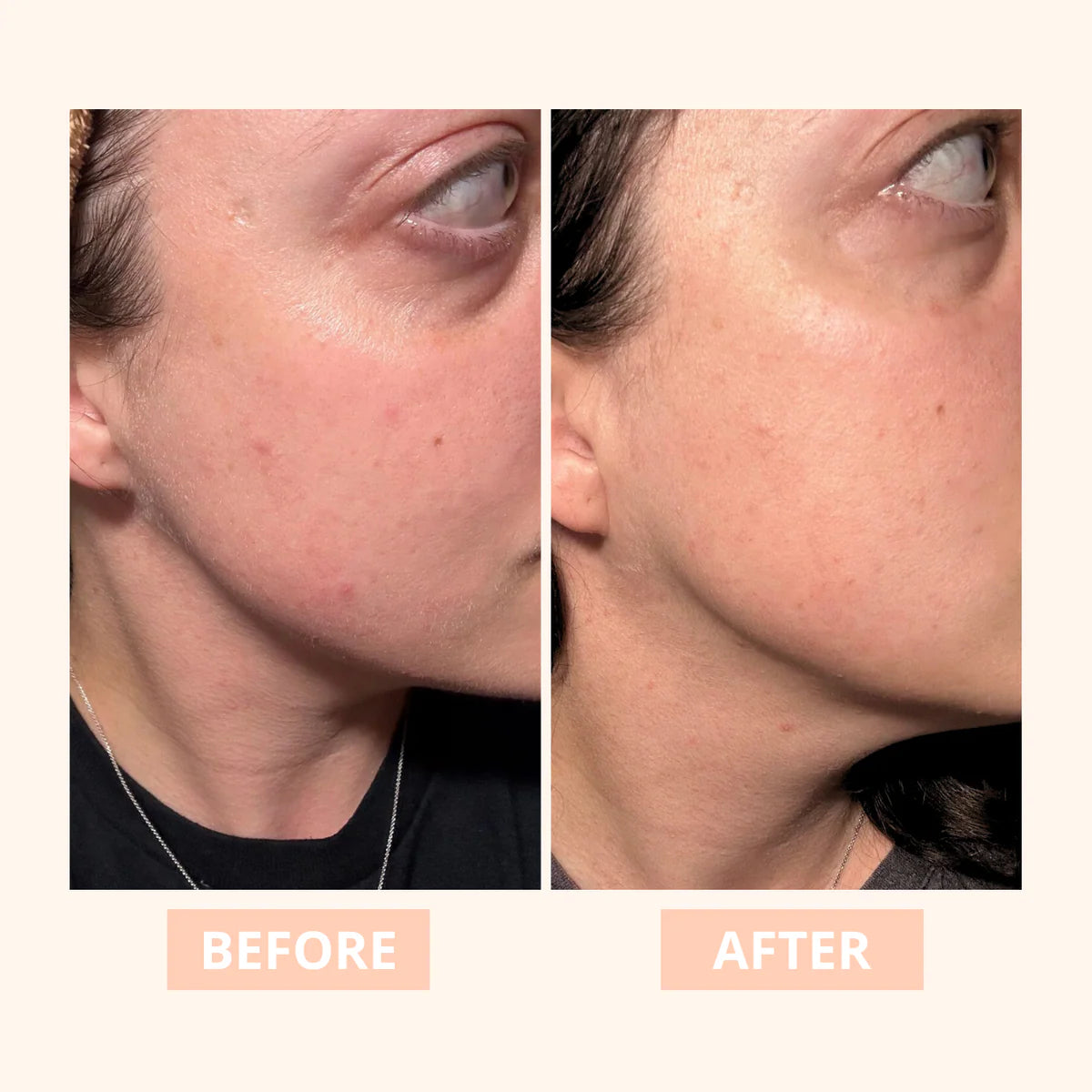 Truly - Resurfacing 10% AHA Serum